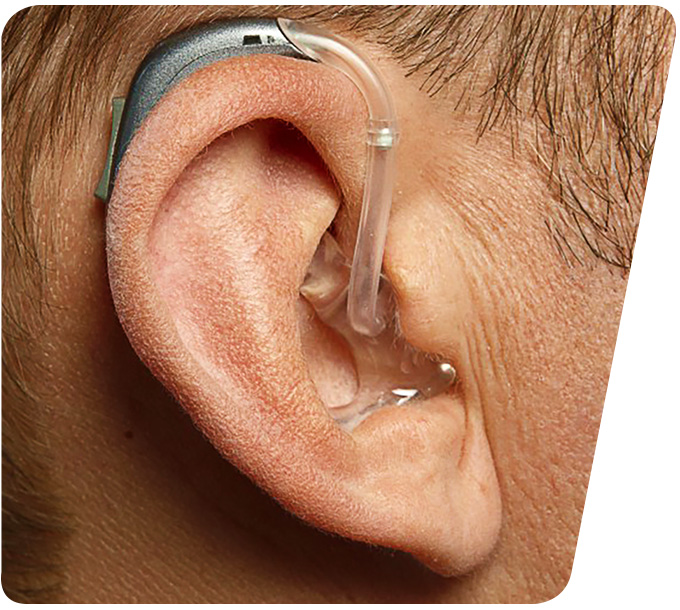 Nahaufnahme eines HdO-Hörgerät (Hinter-dem-Ohr), das hinter dem Ohr einer Person getragen wird, mit sichtbarem Ohrpassstück und transparentem Schallschlauch.