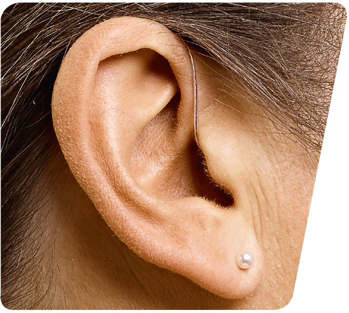 Nahaufnahme eines menschlichen Ohrs mit einem dezenten Mini-Ex-Hörgerät, kaum sichtbar hinter dem Ohr.